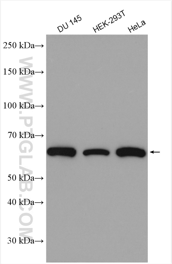 WB analysis using 14517-1-AP