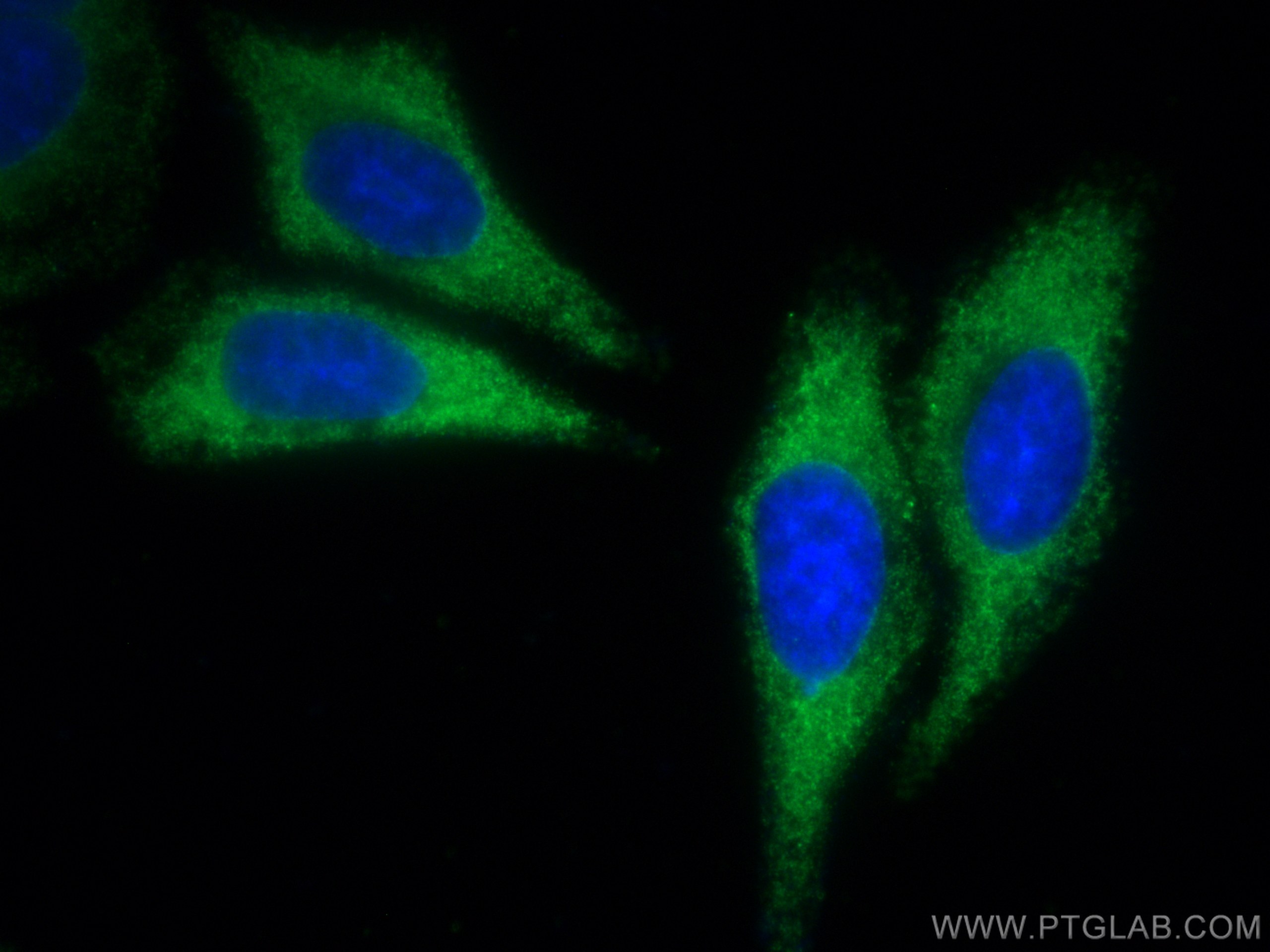 IF Staining of HepG2 using CL488-67746