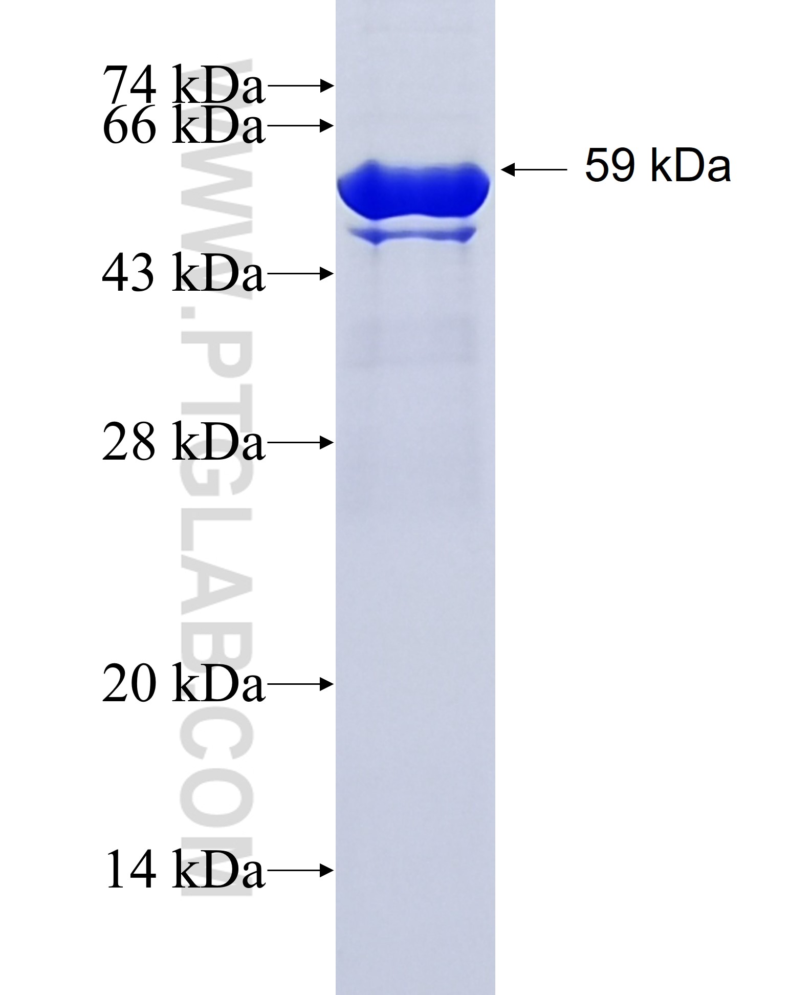 USP14 fusion protein Ag5979 SDS-PAGE