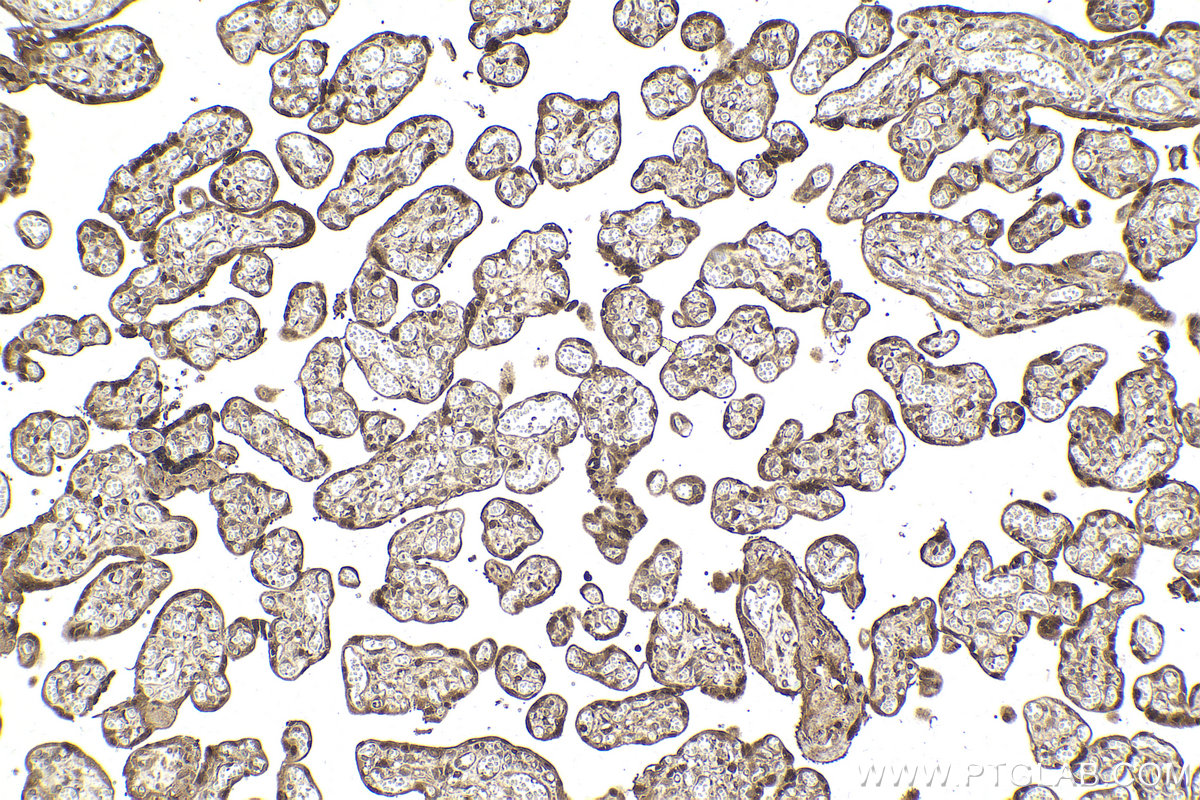 IHC staining of human placenta using 14354-1-AP