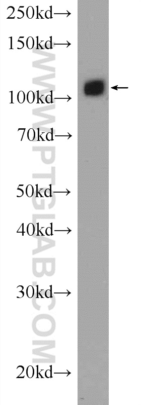 WB analysis of mouse brain using 14354-1-AP