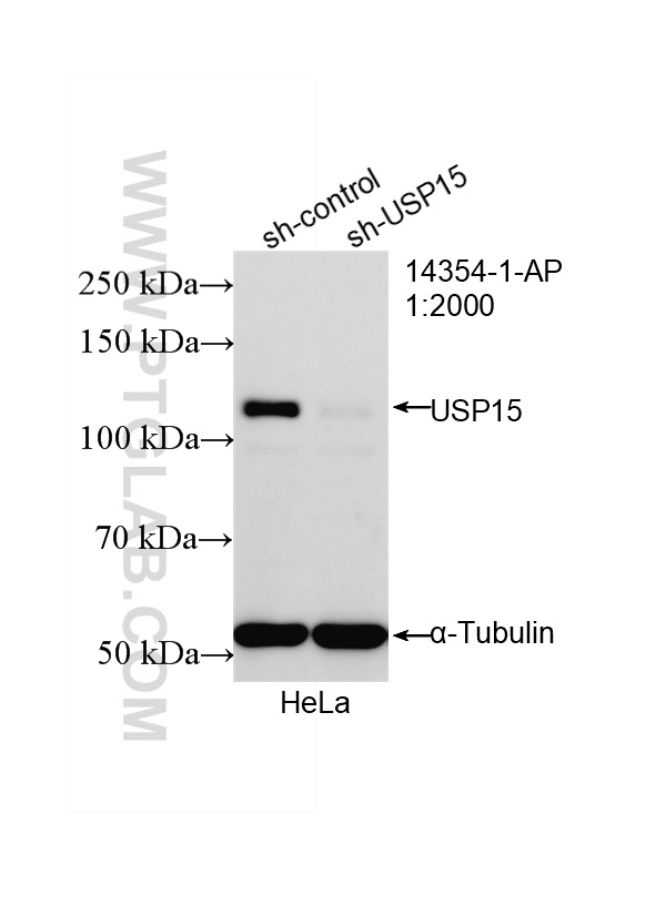 WB result of USP15 antibody (14354-1-AP; 1:2000; incubated at room temperature for 1.5 hours) with sh-Control and sh-USP15 transfected HeLa cells. WB analysis of HeLa using 14354-1-AP