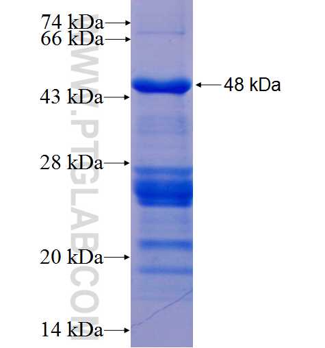 USP16 fusion protein Ag5185 SDS-PAGE USP16 fusion protein Ag5185 SDS-PAGE