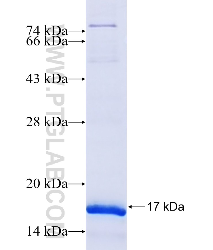USP17 fusion protein Ag17228 SDS-PAGE USP17 fusion protein Ag17228 SDS-PAGE