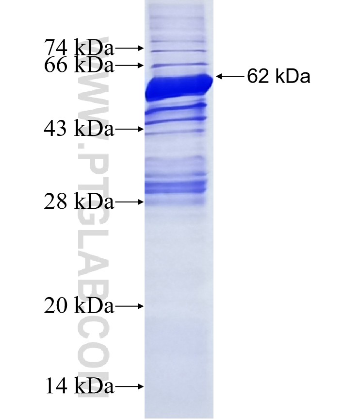 USP18 fusion protein Ag2785 SDS-PAGE