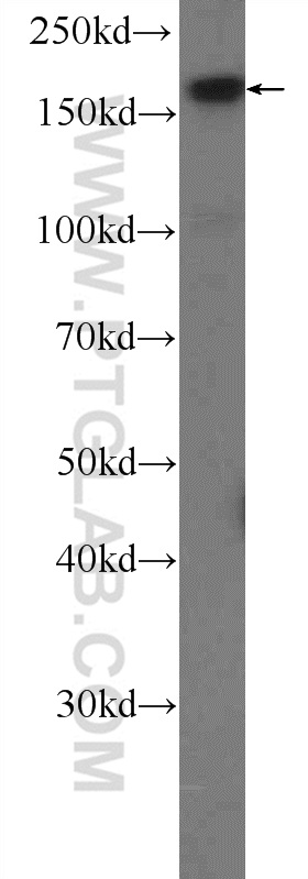 WB analysis of Jurkat using 25768-1-AP