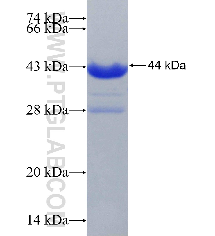 USP2 fusion protein Ag31103 SDS-PAGE USP2 fusion protein Ag31103 SDS-PAGE