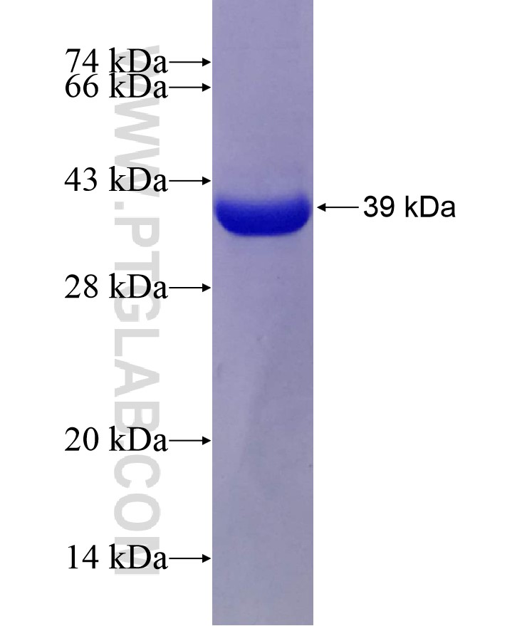 USP2 fusion protein Ag7741 SDS-PAGE USP2 fusion protein Ag7741 SDS-PAGE