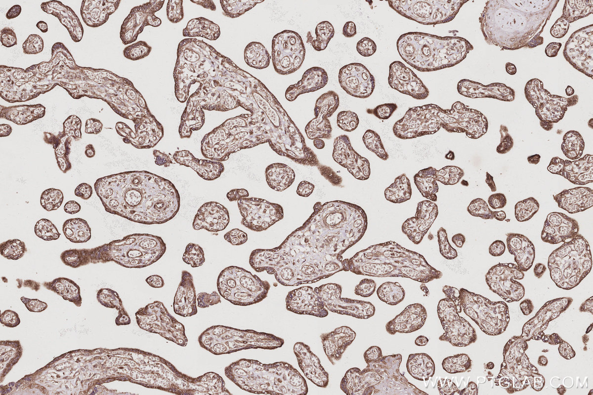 IHC staining of human placenta using 17491-1-AP IHC staining of human placenta using 17491-1-AP