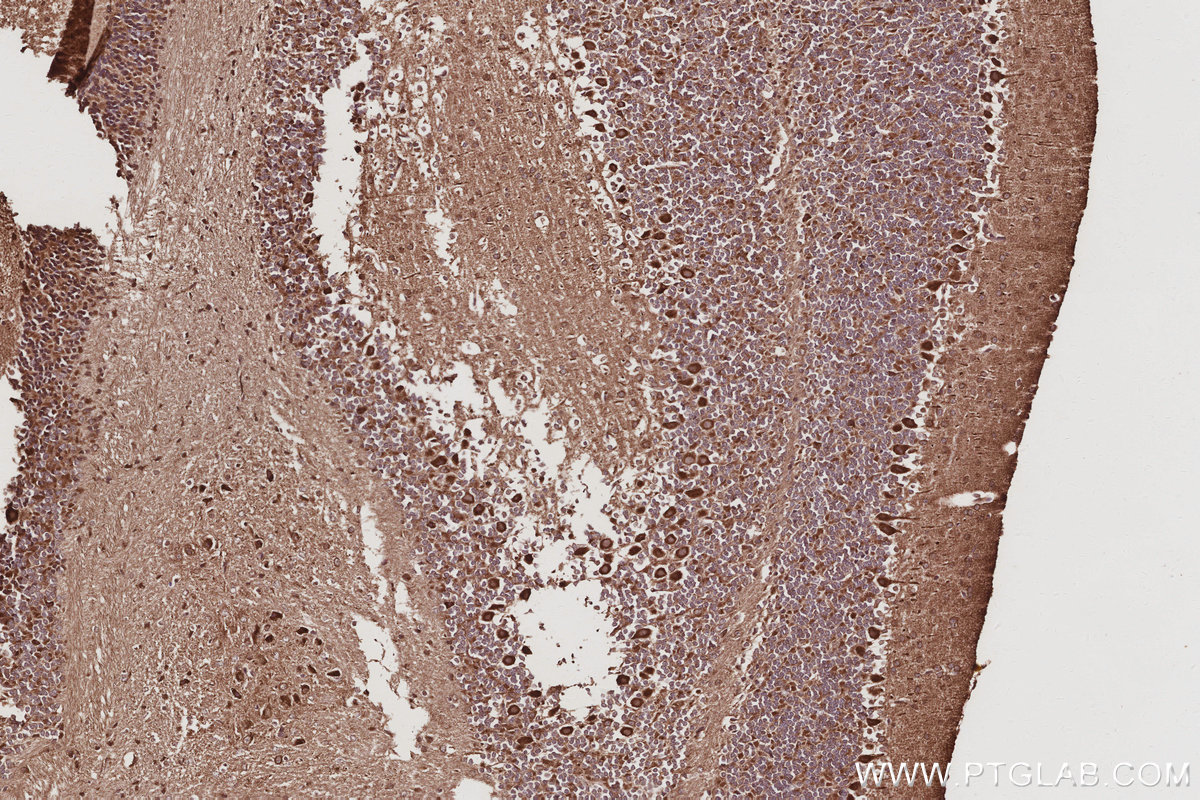 IHC staining of mouse cerebellum using 17491-1-AP IHC staining of mouse cerebellum using 17491-1-AP