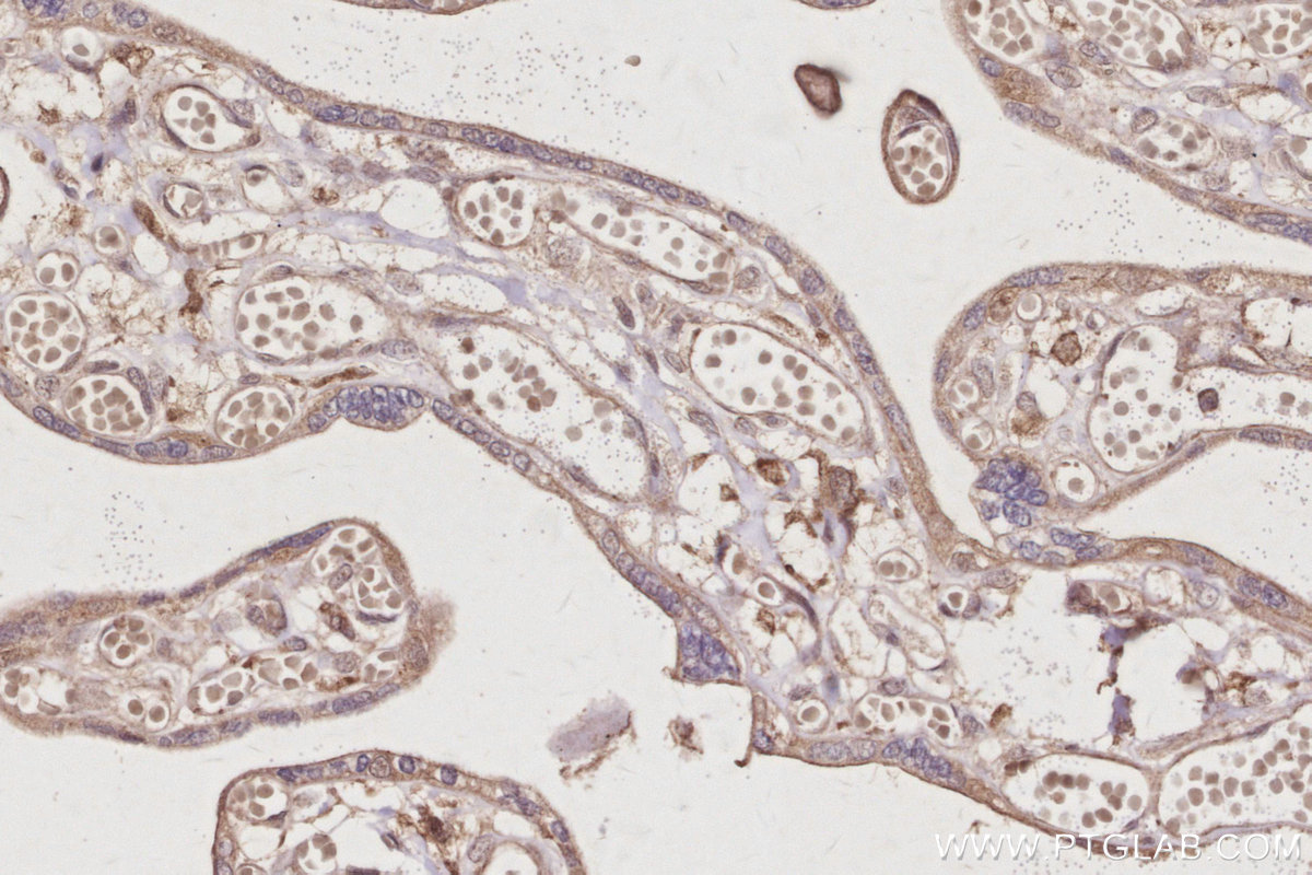 IHC staining of human placenta using 13126-1-AP IHC staining of human placenta using 13126-1-AP