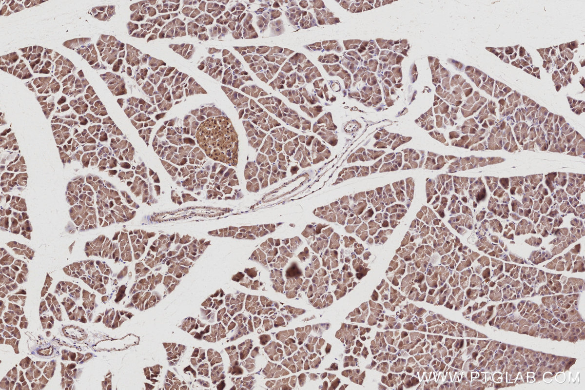 IHC staining of mouse pancreas using 13126-1-AP IHC staining of mouse pancreas using 13126-1-AP