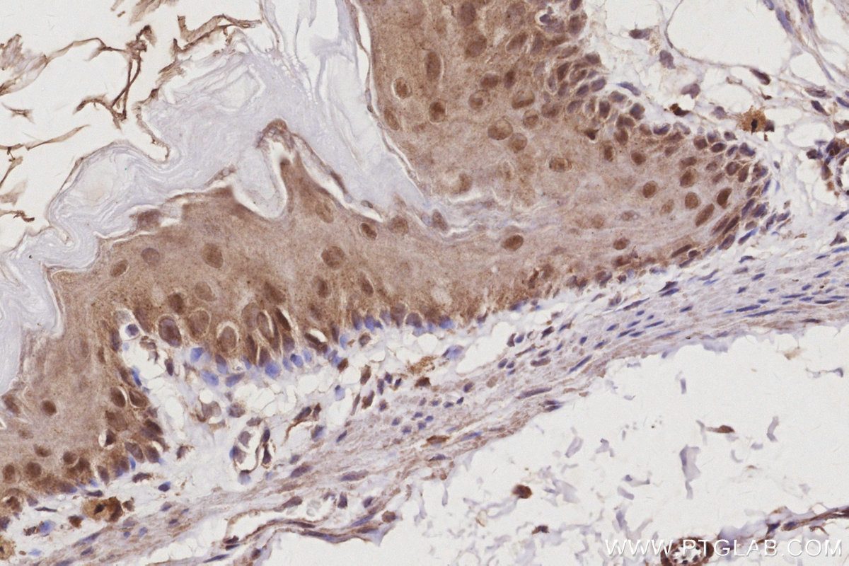 IHC staining of mouse stomach using 13126-1-AP IHC staining of mouse stomach using 13126-1-AP