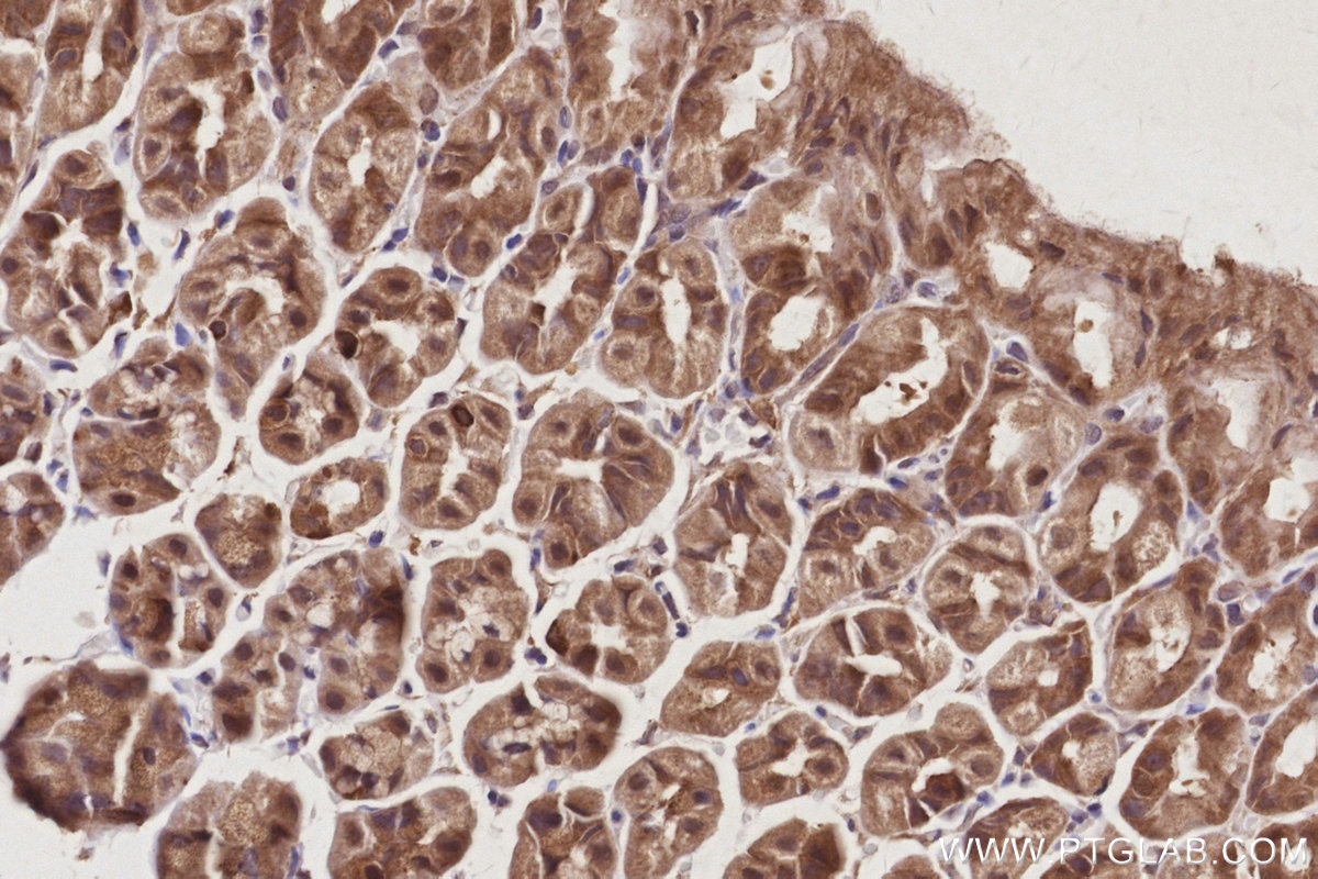 IHC staining of mouse stomach using 13126-1-AP IHC staining of mouse stomach using 13126-1-AP