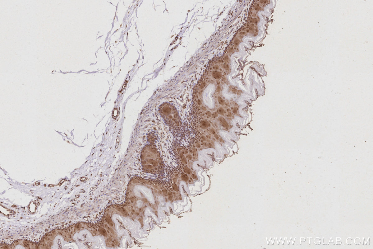 IHC staining of rat stomach using 13126-1-AP IHC staining of rat stomach using 13126-1-AP