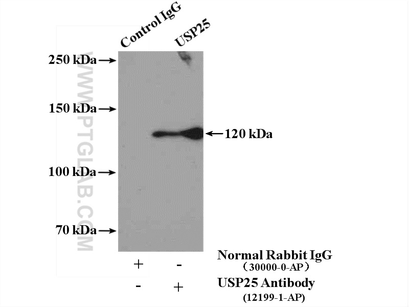IP experiment of RAW 264.7 using 12199-1-AP (same clone as 12199-1-PBS)