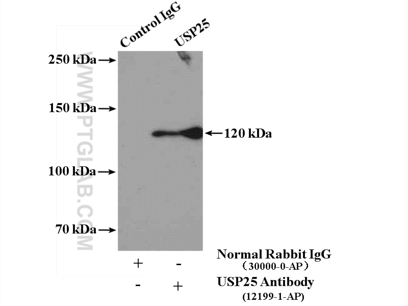 IP experiment of RAW 264.7 using 12199-1-AP