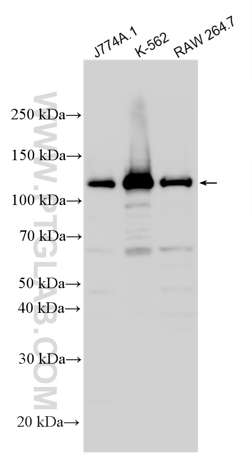 Various lysates were subjected to SDS PAGE followed by western blot with 12199-1-AP (USP25 antibody) at dilution of 1:500 incubated at room temperature for 1.5 hours. WB analysis using 12199-1-AP