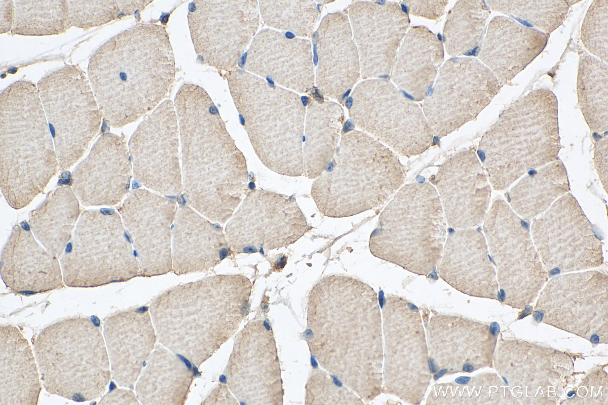 IHC staining of mouse skeletal muscle using 67769-1-Ig (same clone as 67769-1-PBS)