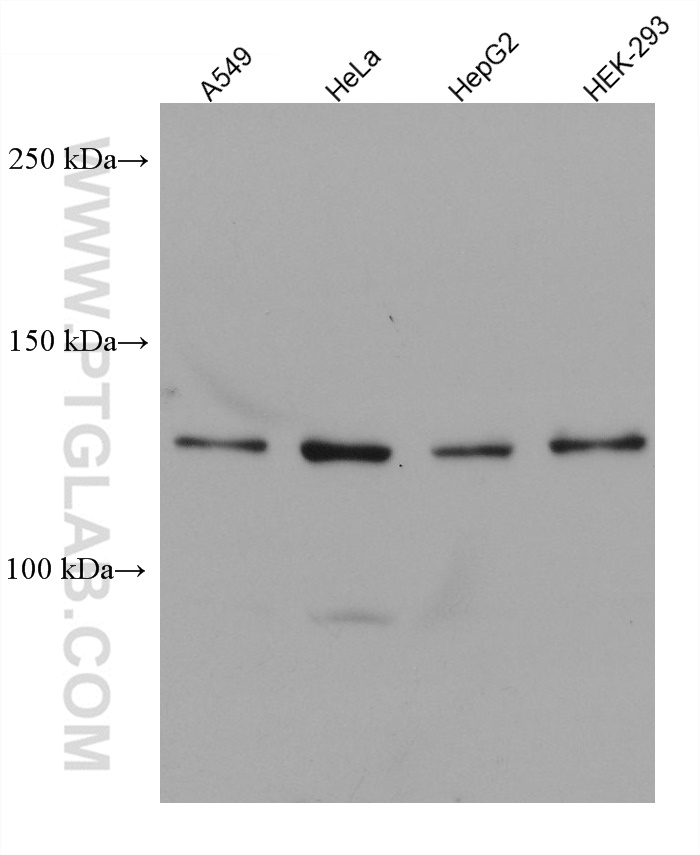 WB analysis using 67769-1-Ig (same clone as 67769-1-PBS)