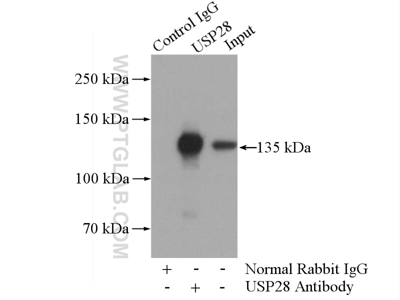 IP experiment of HeLa using 17707-1-AP