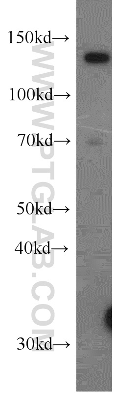 WB analysis of HeLa using 17707-1-AP