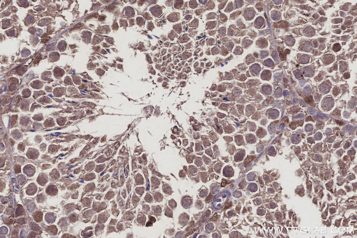 IHC staining of mouse testis using 27522-1-AP