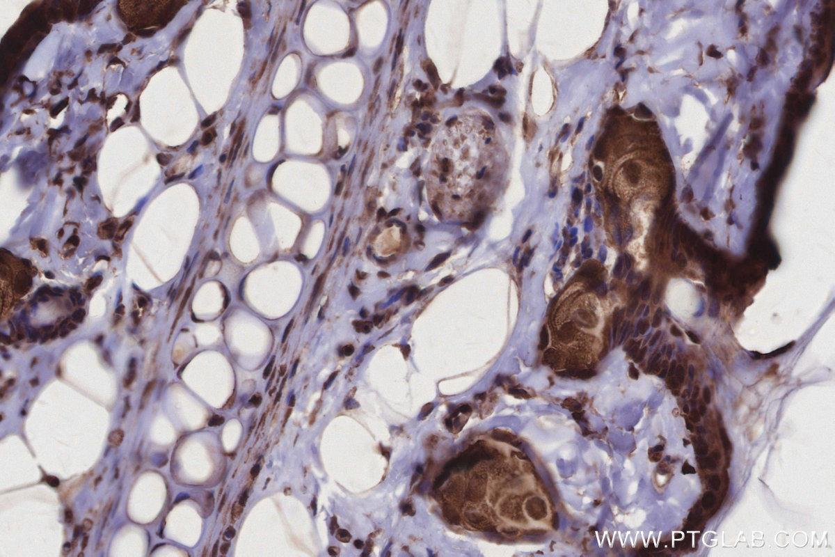 IHC staining of rat skin using 27522-1-AP