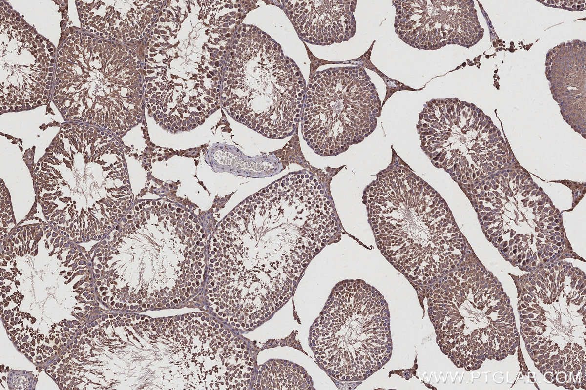 IHC staining of rat testis using 27522-1-AP