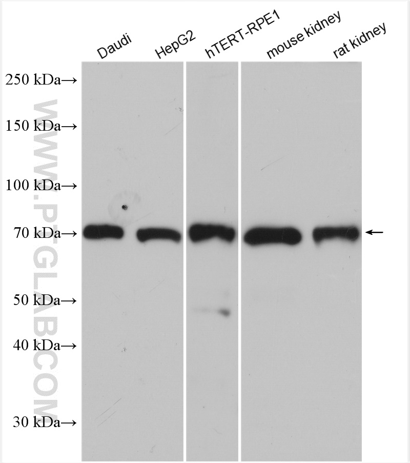 WB analysis using 15402-1-AP