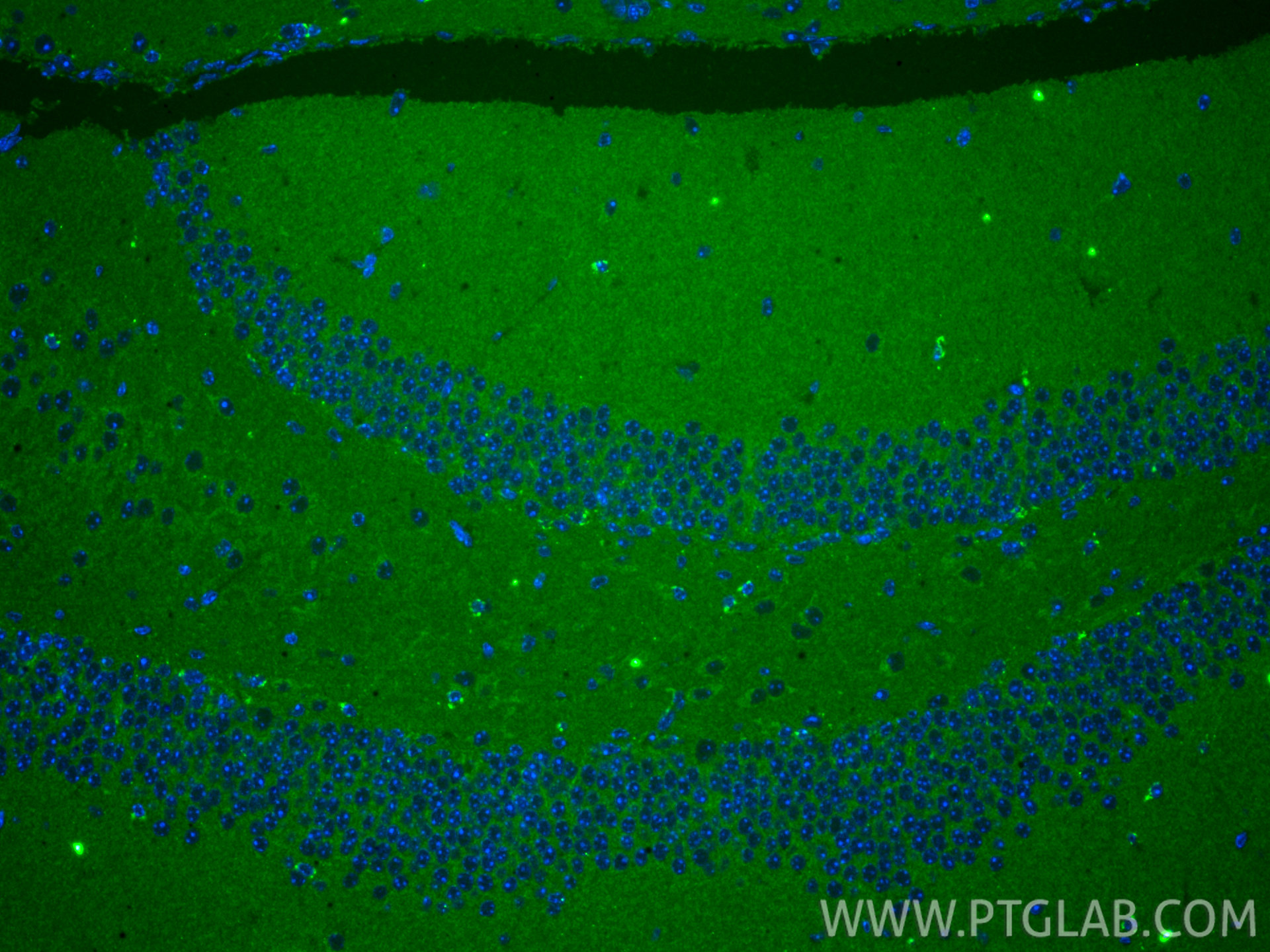 IF Staining of mouse brain using 83240-5-RR IF Staining of mouse brain using 83240-5-RR