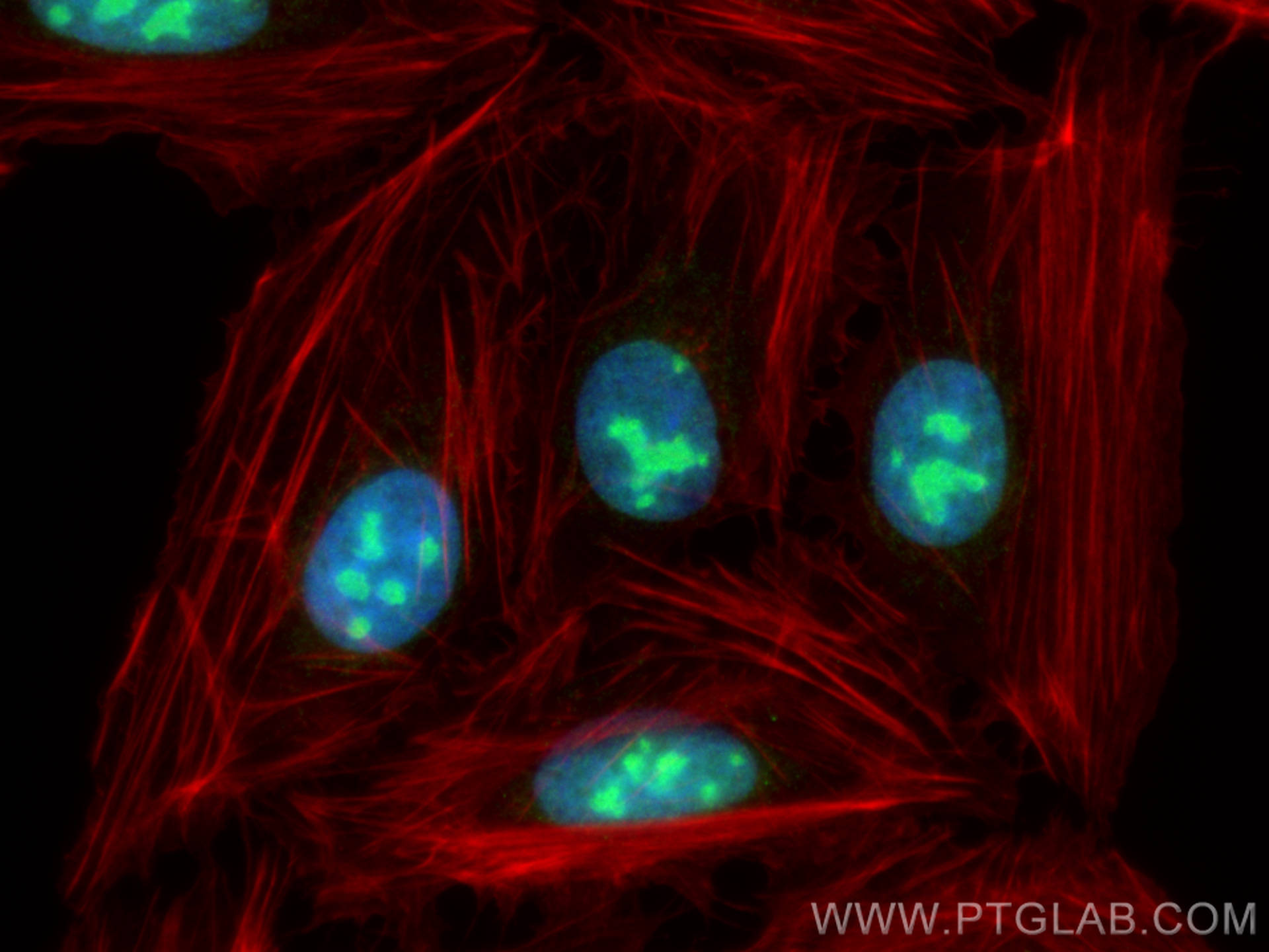 IF Staining of U2OS using 14783-1-AP