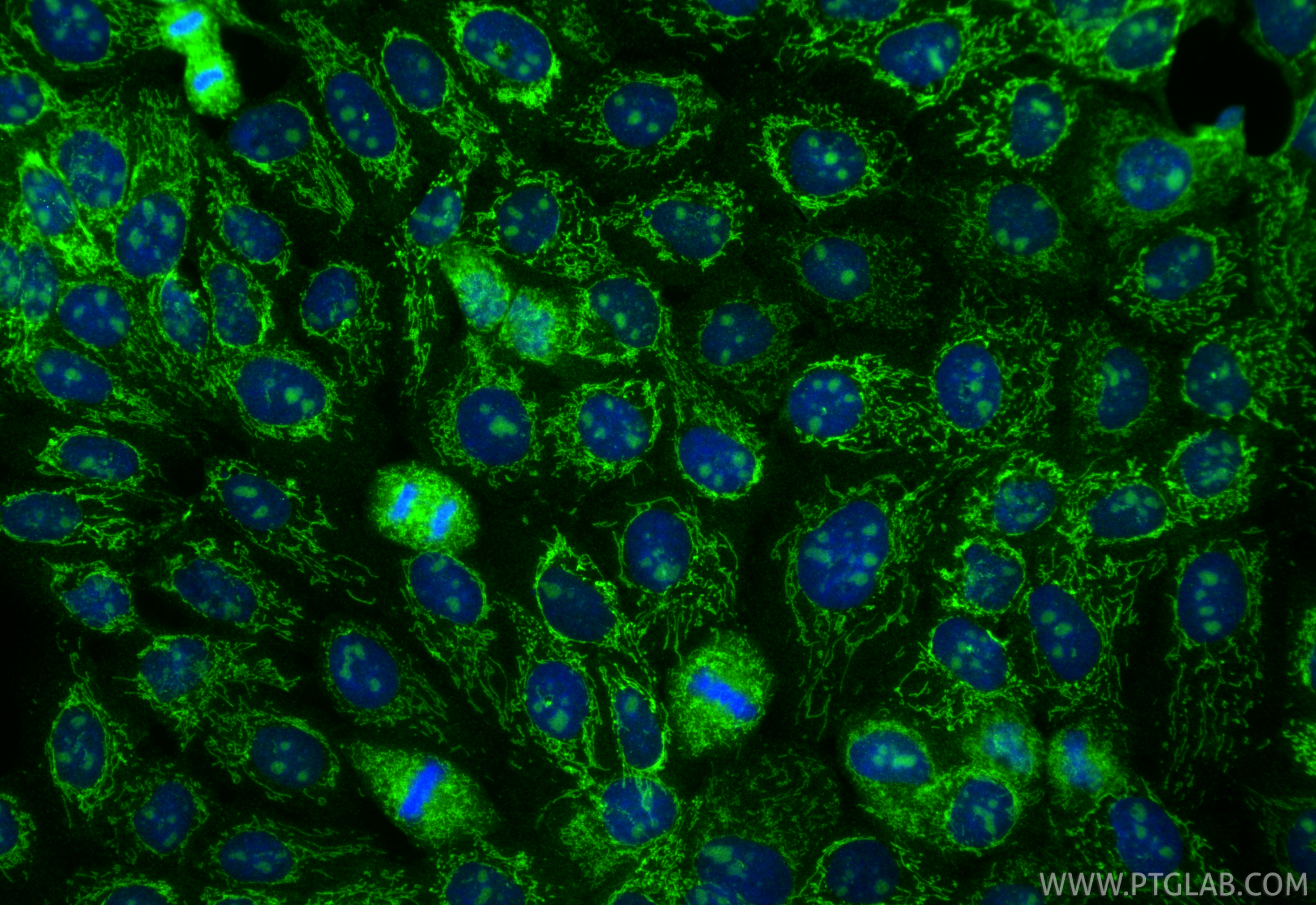 Immunofluorescent analysis of (4% PFA) fixed A431 cells using USP36 antibody (14783-1-AP) at dilution of 1:400 and CoraLite®488-Conjugated Goat Anti-Rabbit IgG(H+L) (<a class='green' href='/productredirect?CatalogNo=SA00013-2' target='_blank'>SA00013-2</a>). IF Staining of A431 using 14783-1-AP