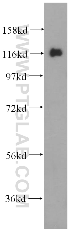 WB analysis of Jurkat using 14783-1-AP