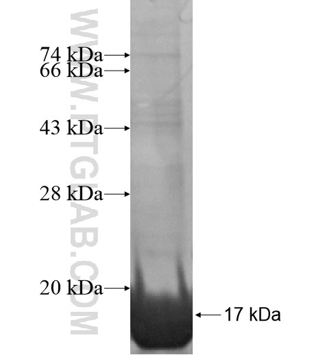 USP36 fusion protein Ag15903 SDS-PAGE USP36 fusion protein Ag15903 SDS-PAGE