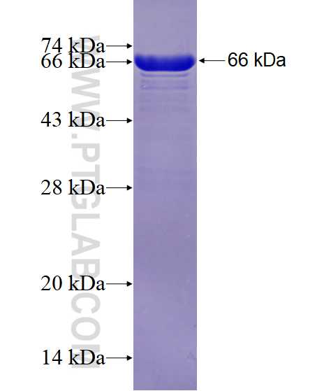 USP37 fusion protein Ag29031 SDS-PAGE USP37 fusion protein Ag29031 SDS-PAGE