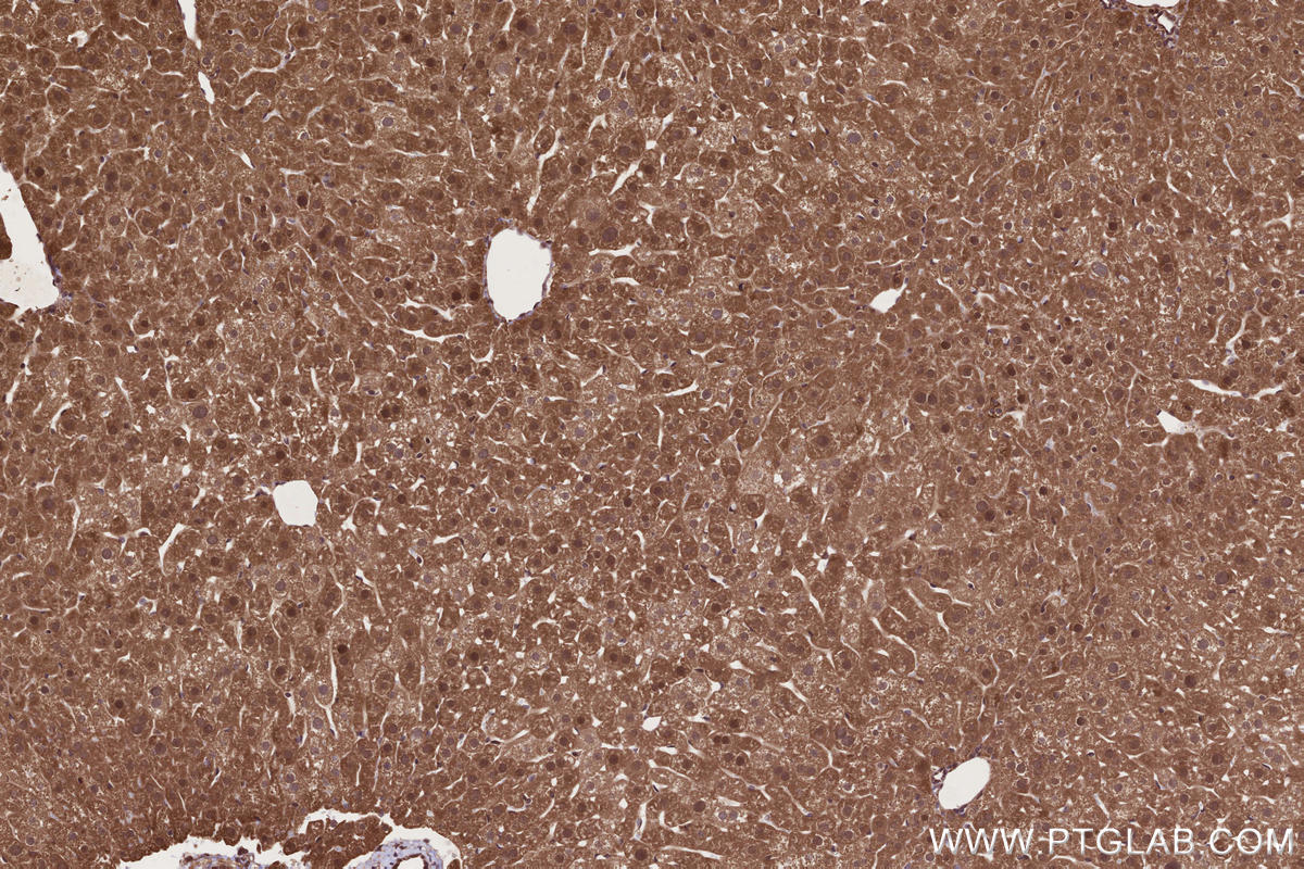 IHC staining of mouse liver using 17767-1-AP IHC staining of mouse liver using 17767-1-AP