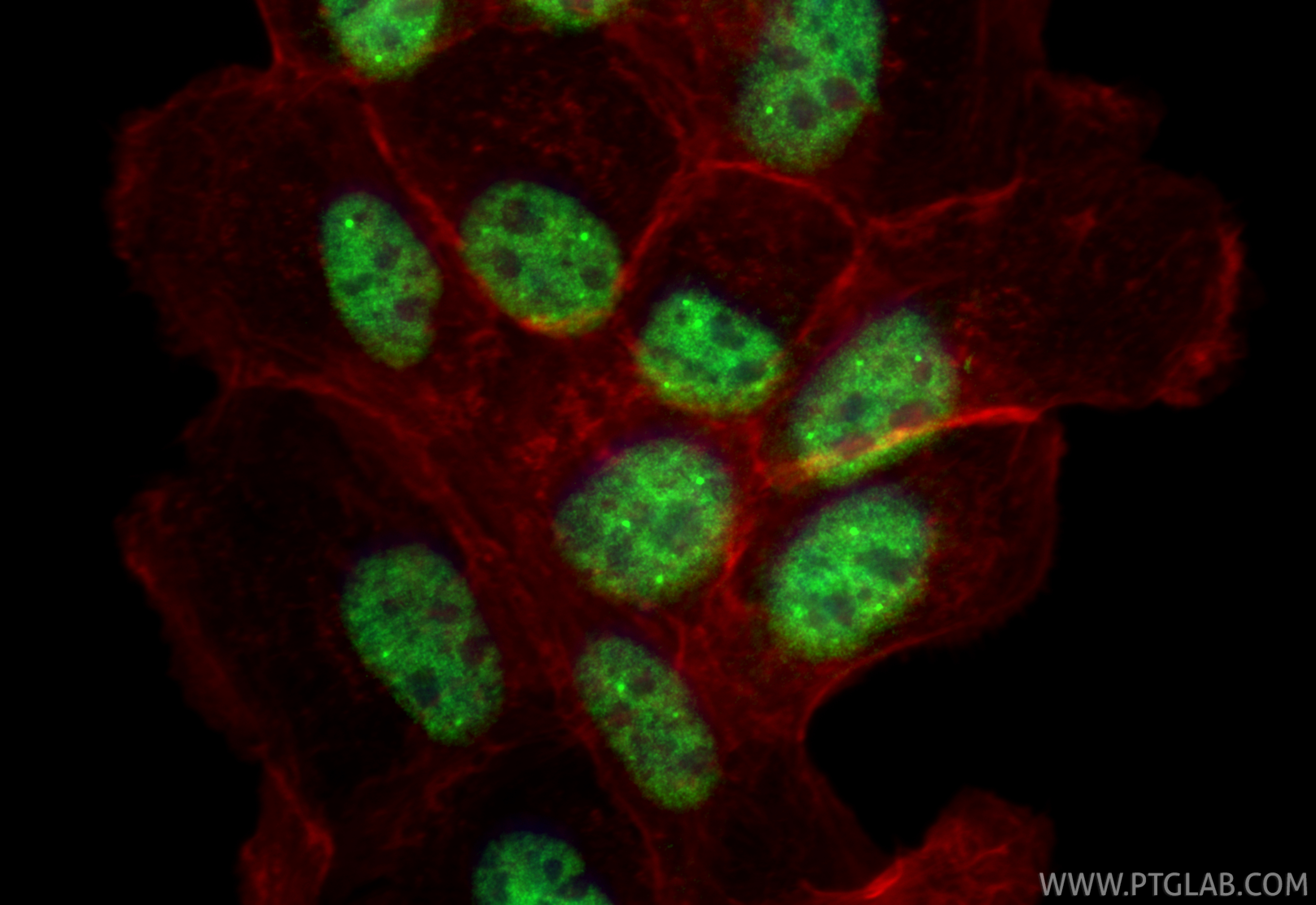 Immunofluorescent analysis of (4% PFA) fixed A431 cells using USP39 antibody (23865-1-AP) at dilution of 1:200 and CoraLite®488-Conjugated Goat Anti-Rabbit IgG(H+L) (<a class='green' href='/productredirect?CatalogNo=SA00013-2' target='_blank'>SA00013-2</a>), CL594-Phalloidin (red). IF Staining of A431 using 23865-1-AP
