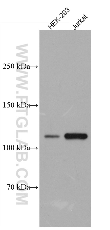 WB analysis using 66822-1-Ig