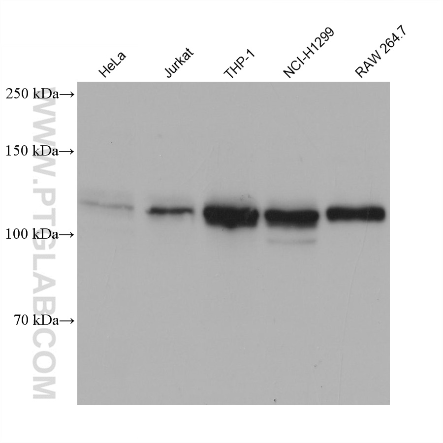 WB analysis using 66822-1-Ig