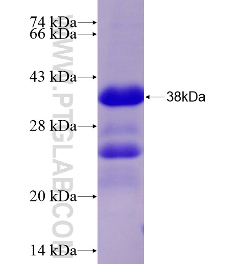 USP4 fusion protein Ag28297 SDS-PAGE