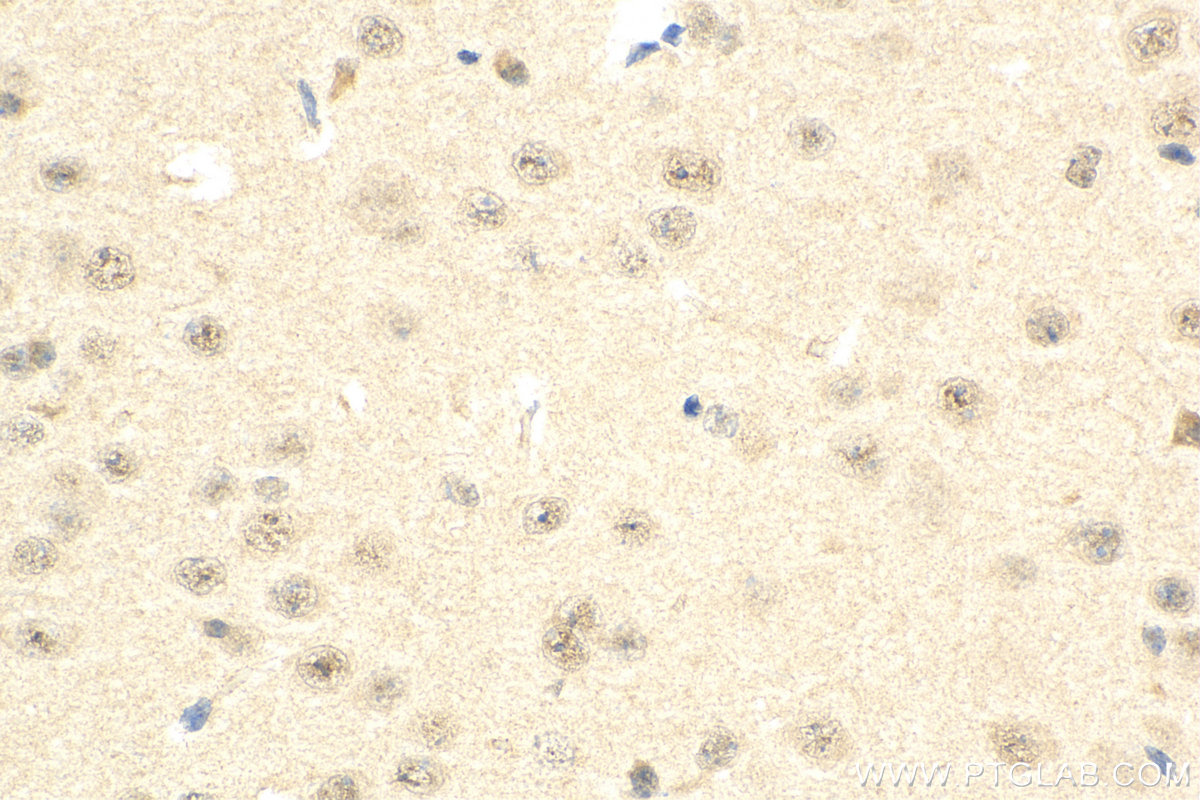 IHC staining of mouse brain using 18811-1-AP