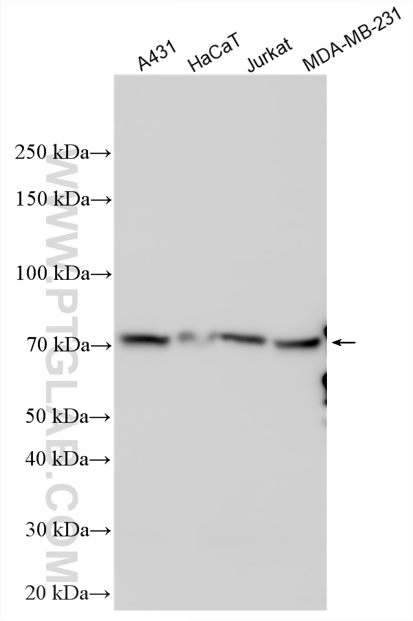 Various lysates were subjected to SDS PAGE followed by western blot with 32375-1-AP (USP43 antibody) at dilution of 1:2000 incubated at room temperature for 1.5 hours. WB analysis using 32375-1-AP