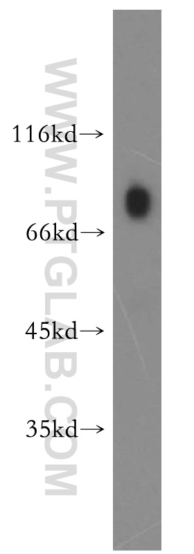 WB analysis of human placenta using 15521-1-AP