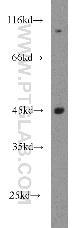 WB analysis of SGC-7901 using 15866-1-AP