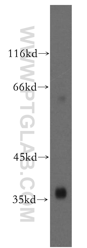 WB analysis of human kidney using 13502-1-AP