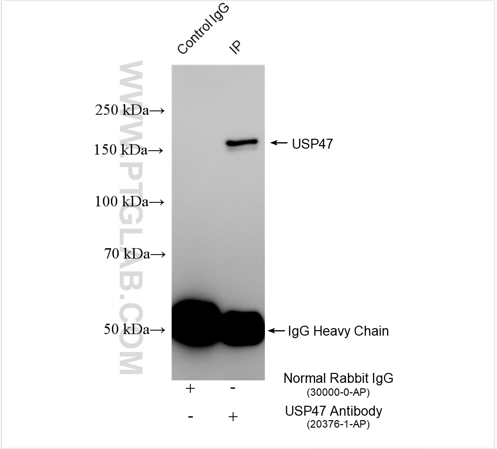 IP experiment of HeLa using 20376-1-AP