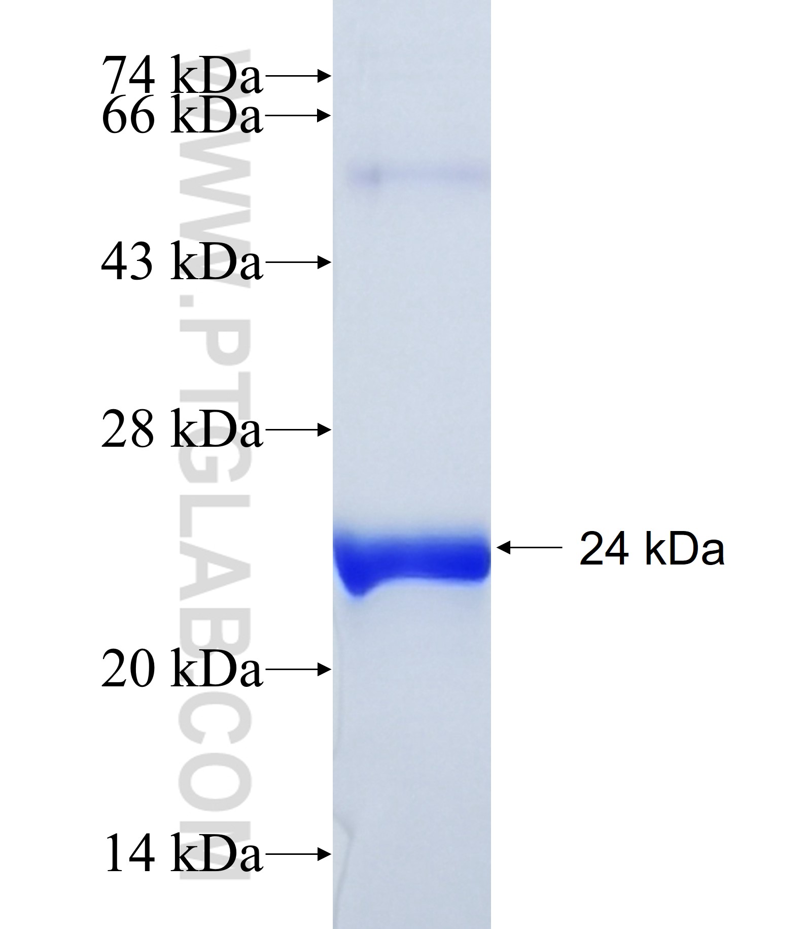 USP47 fusion protein Ag39907 SDS-PAGE USP47 fusion protein Ag39907 SDS-PAGE