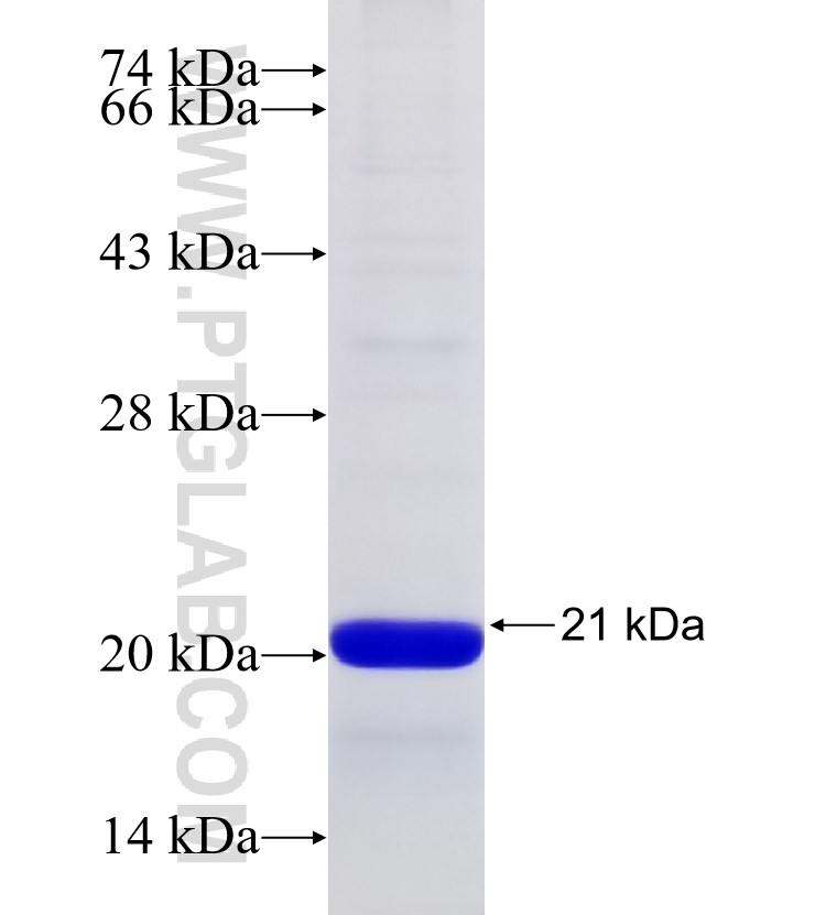 USP50 fusion protein Ag31275 SDS-PAGE