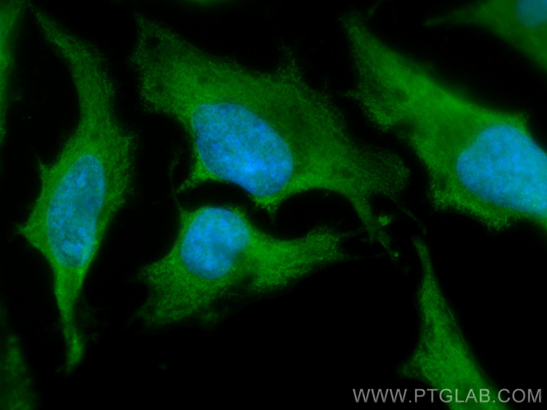 IF Staining of HeLa using CL488-66514